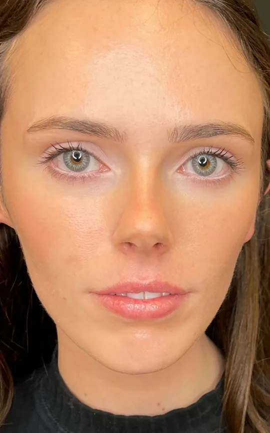 Lip Treatment, before treatment