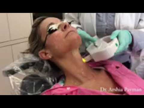 IPL Therapy for sun damage, melasma and rosacea thumbnail